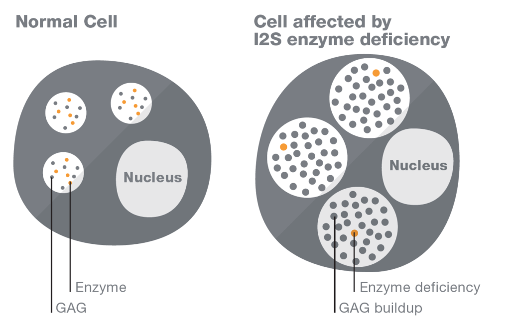 Hunter Syndrome Clinical Overview