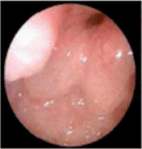 Ear, nose and throat