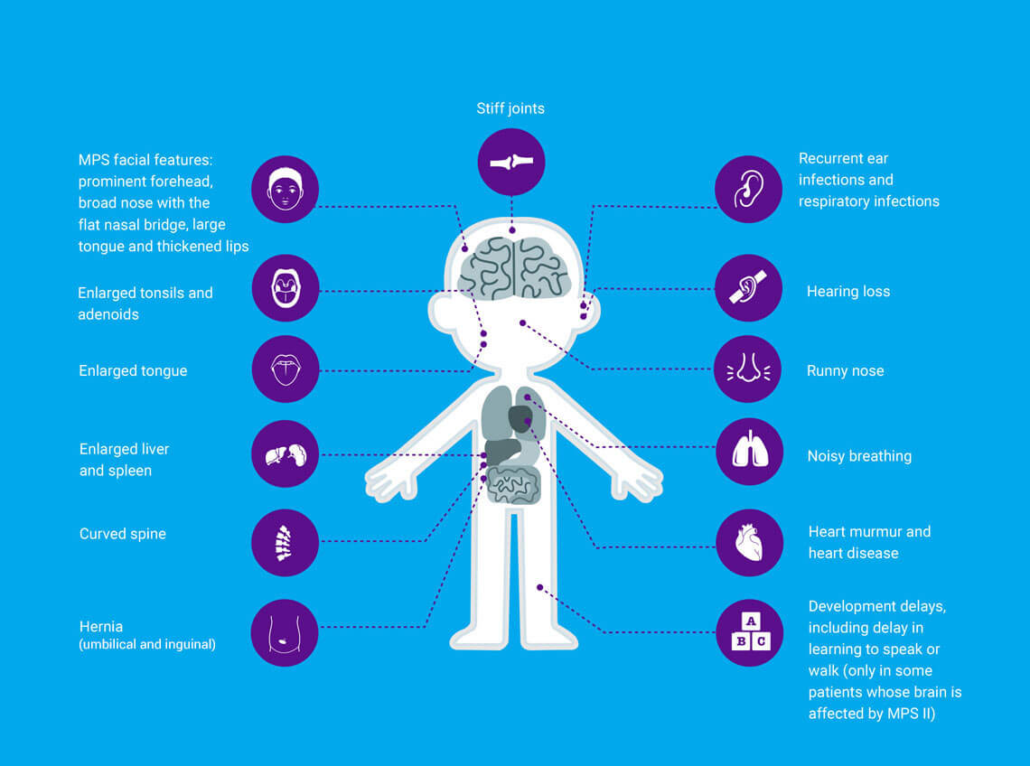 Key symptoms
