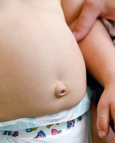 Enlarged liver and spleen in young boys may be symptoms of Hunter syndrome