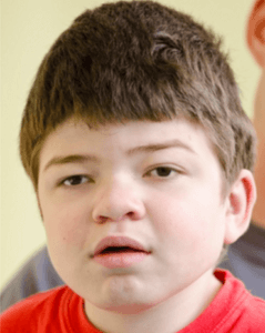 Coarse Facial Features