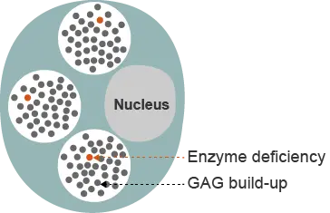 Hunter syndrome cell affected by I2S enzyme deficiency