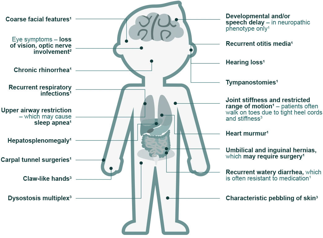 Hunter syndrome signs and symptoms diagram cartoon boy 