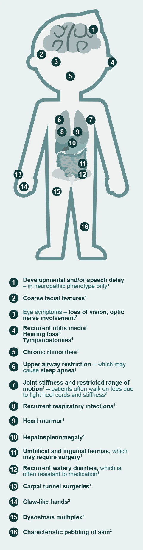 Hunter syndrome signs and symptoms diagram cartoon boy 